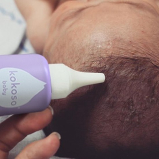 Slika Kokoso Baby® Happy Krema za lasišče - proti temencam 50ml